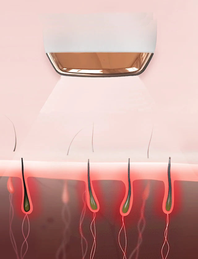IPL Laser Hair Removal Device for Women | Glamour Touch UK