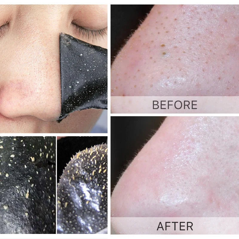 Deep Cleansing Blackhead Removal Nose Strips | Pore Cleaner