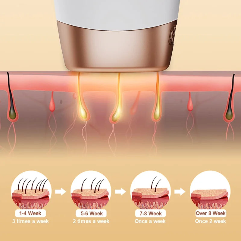 IPL Laser Hair Removal Device for Women | Glamour Touch UK