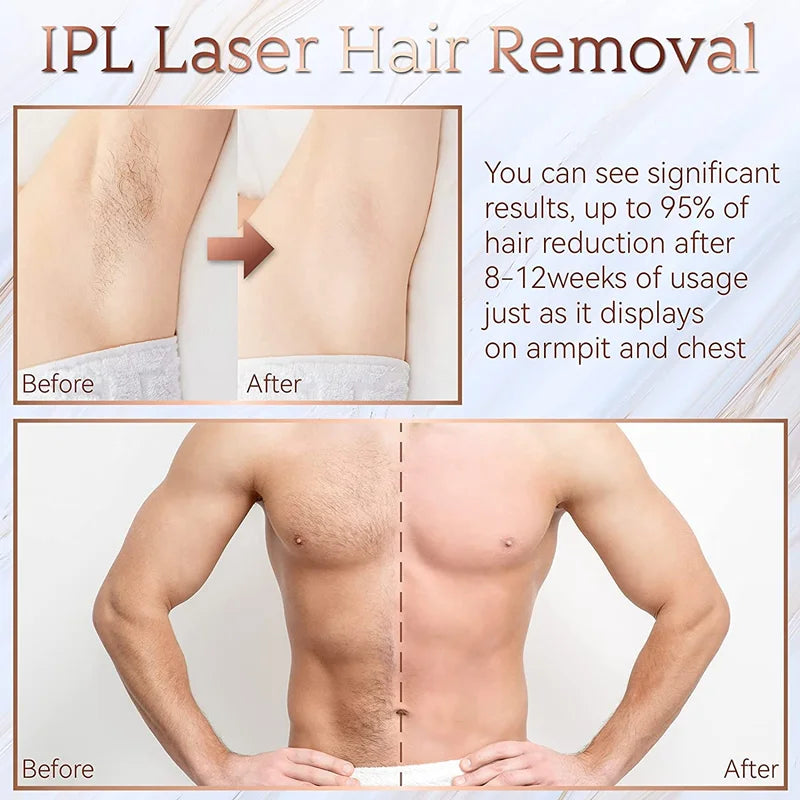IPL Laser Hair Removal Device for Women | Glamour Touch UK