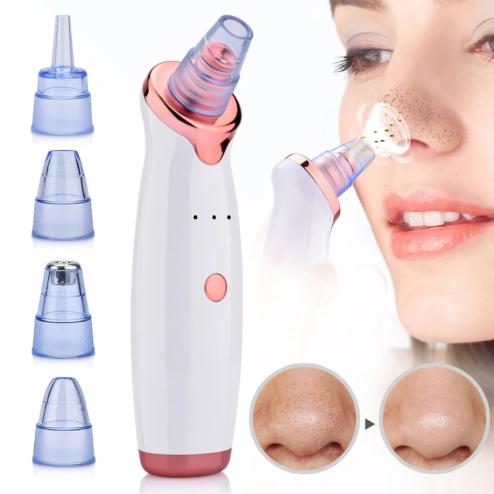 Facial Blackhead Remover | Electric Acne Cleaner | Blackhead Black Point Vacuum Cleaner Tool | Black Spots Pore Cleaner Machine - Glamour Touch