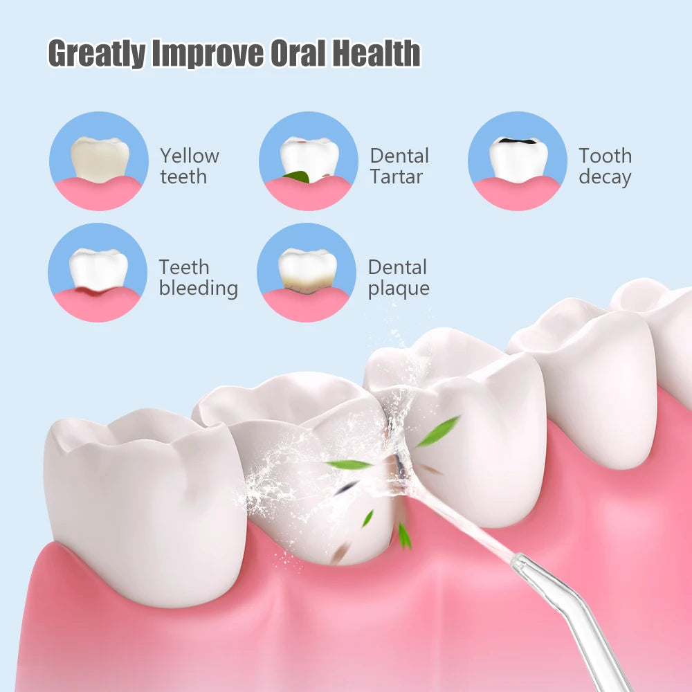 Portable Dental Water Flosser | USB Rechargeable Oral Irrigator