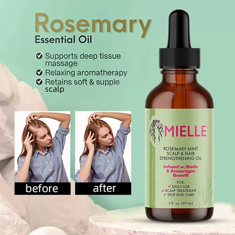 Rosemary Mint Scalp Hair Strengthening Oil Biotin Essential Oils Nourishing Treatment Split Ends Dry All Types - Glamour Touch