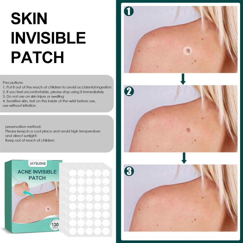 Invisible Acne Patches 120pcs | Pimple Removal Anti-Acne Hydrocolloid Patches Spots Marks Concealer