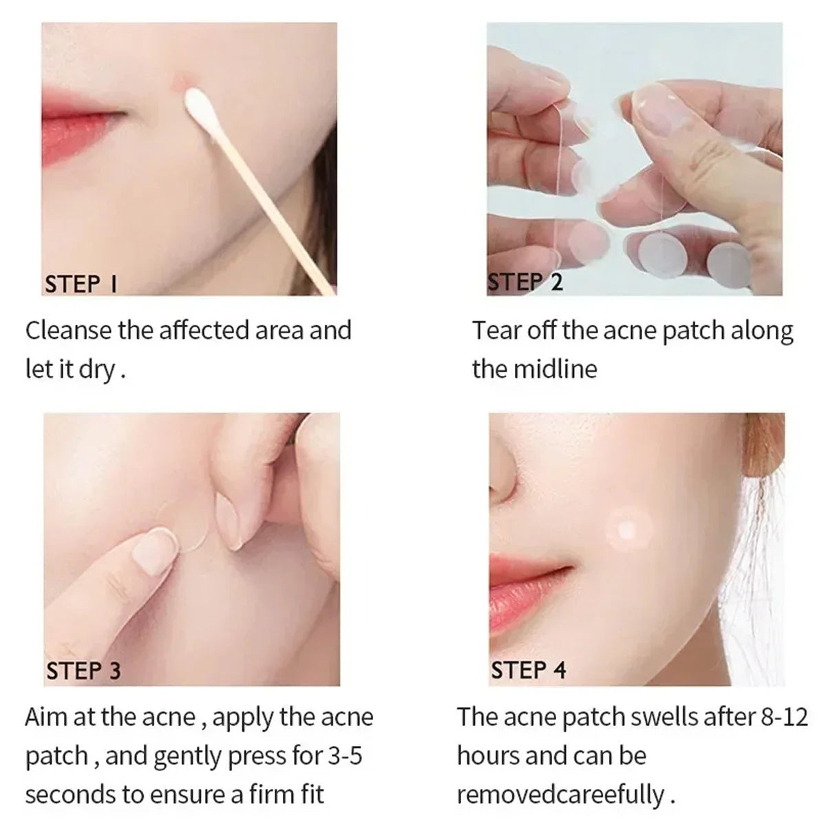 Invisible Acne Patches 120pcs | Pimple Removal Anti-Acne Hydrocolloid Patches Spots Marks Concealer